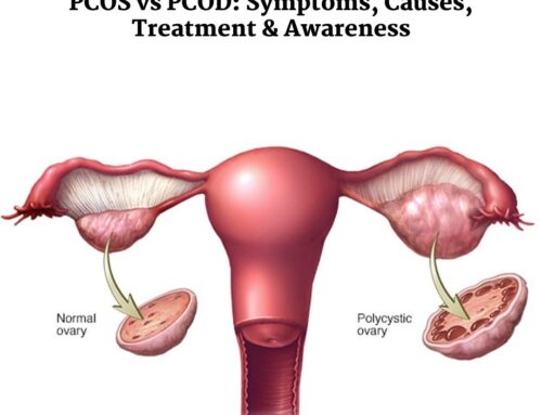 PCOS vs PCOD: Symptoms, Causes, Treatment & Awareness
