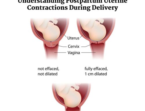 Understanding Postpartum Uterine Contractions During Delivery